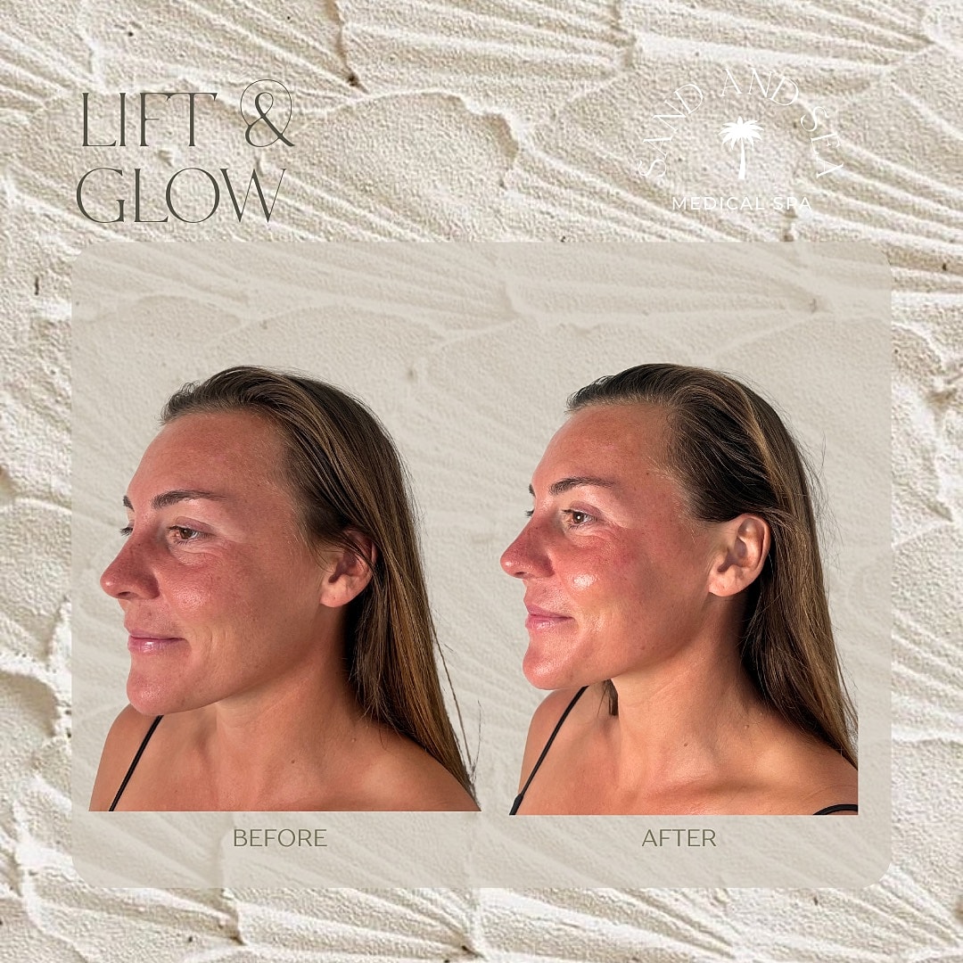 Before and after skin treatment results.