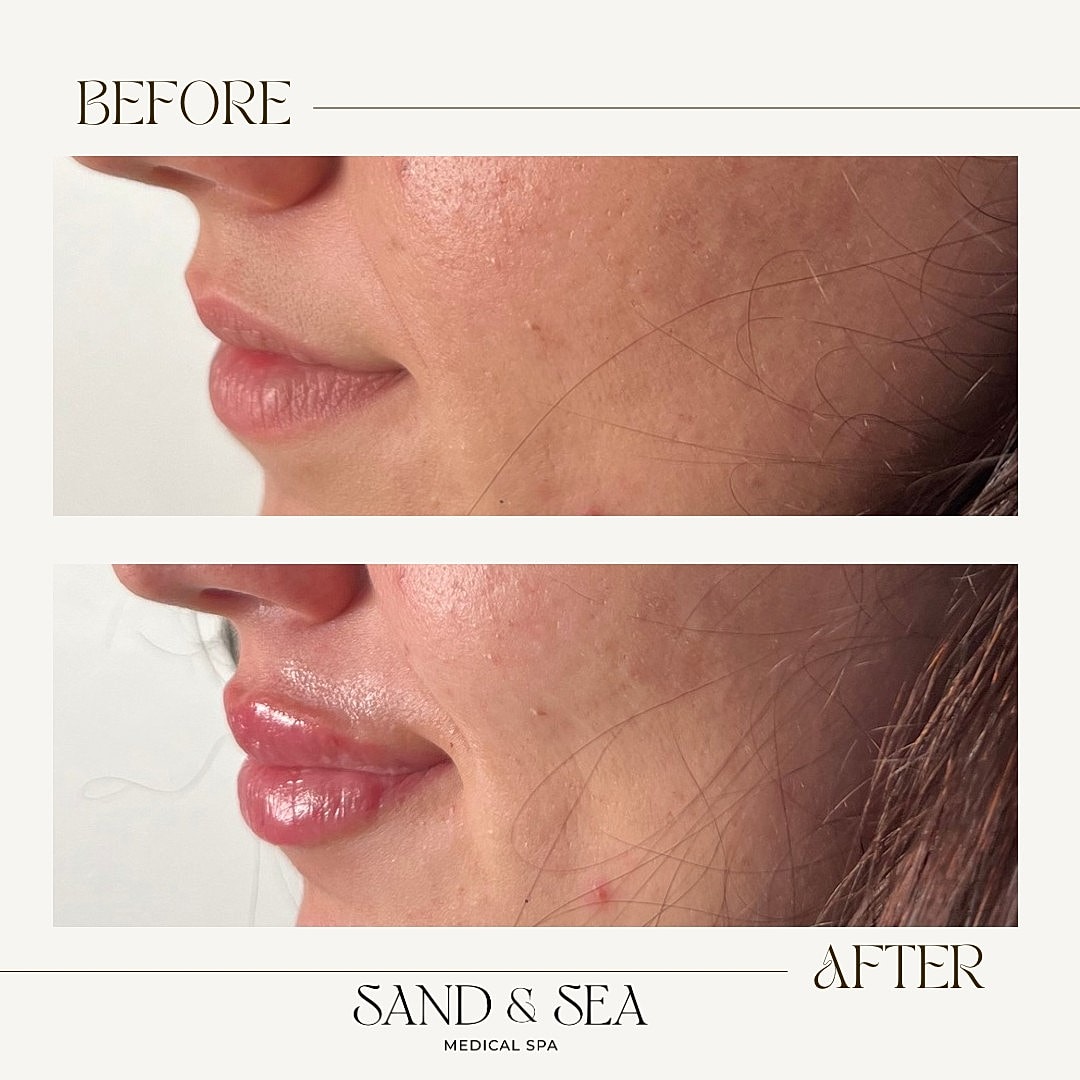 Before and after skincare treatment comparison.