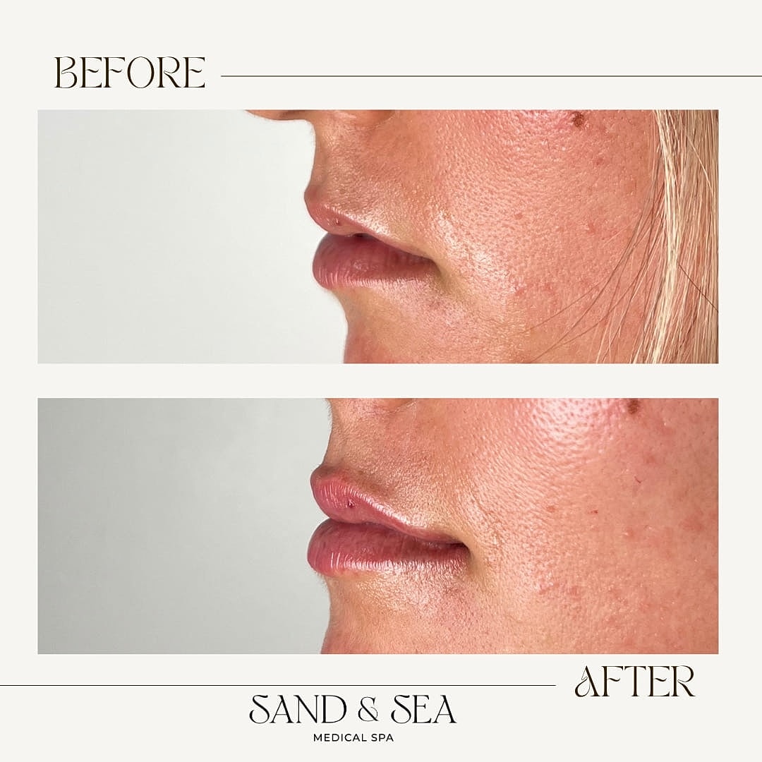 Before and after cosmetic treatment results